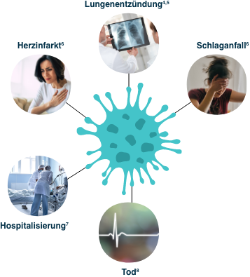 Grippevirus kann Herzinfarkt, Lungenentzündung, Schlaganfall, Hospitalisierung und Tod verursachen